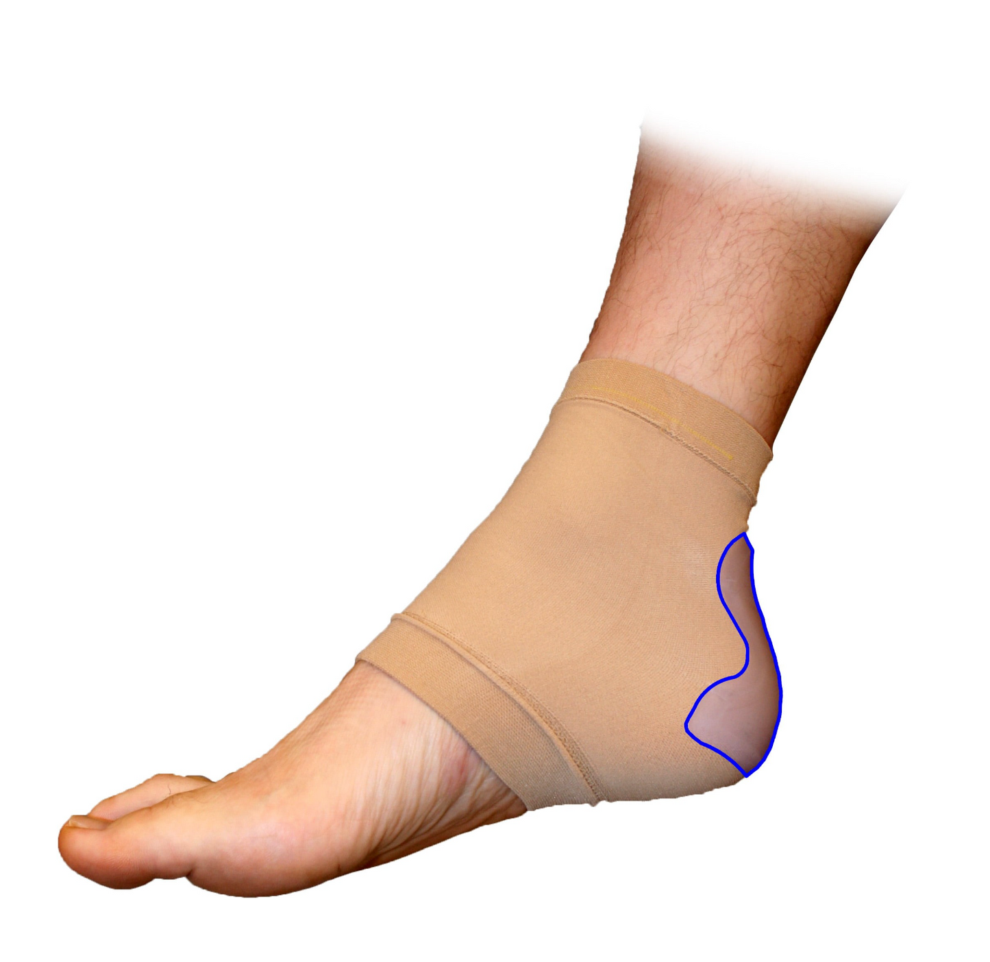 Bunga Achilles Healpad